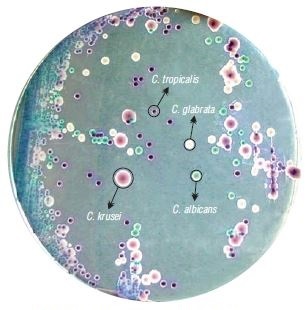 Основа селективного агара HiCrome для грибов Candida модифицир. HiMedia M1456A-100G (уп/100 гр)