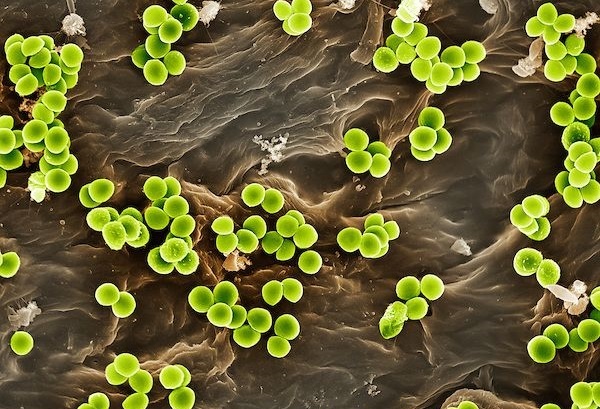 Набор для селекции метициллин резистентных S.aureus HiMedia K058SR-1KT