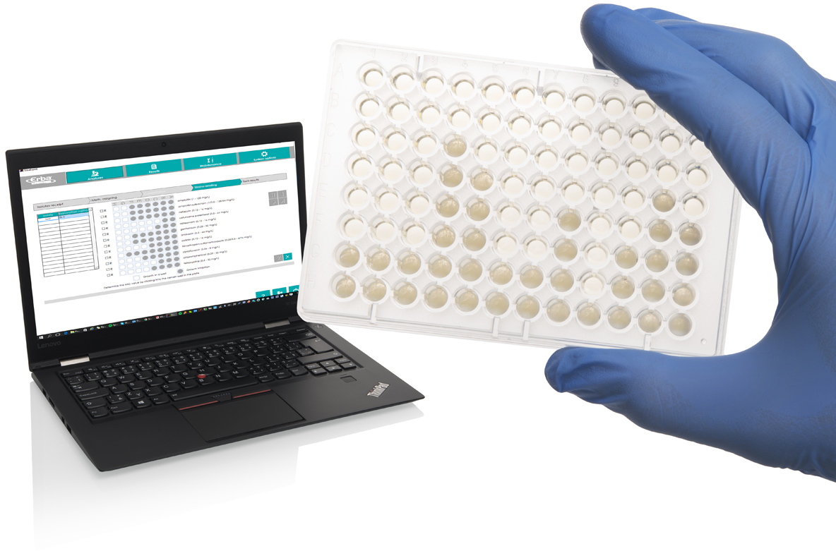 Микробиологический анализатор Erba Lachema ErbaScan