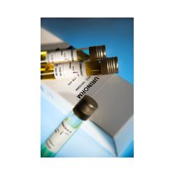 Контрольная моча УРИНОРМ Erba Lachema 10010266 (15 мл)